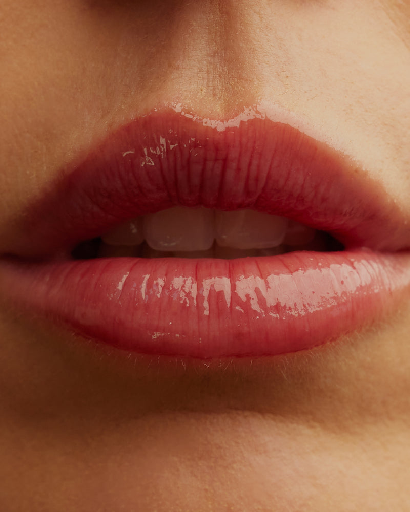 Cutera Laser Genesis