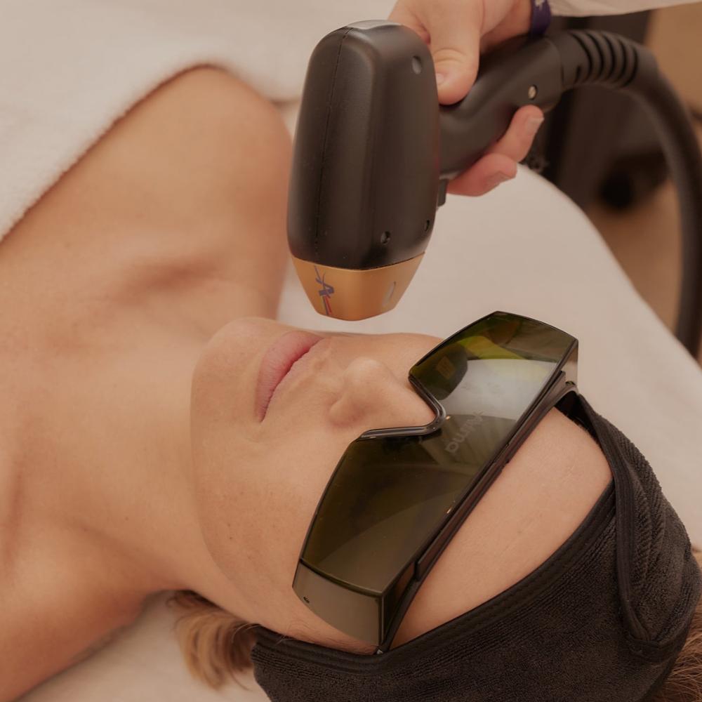 Thermage FLX - Full Face + Complementary Titanium Lifting